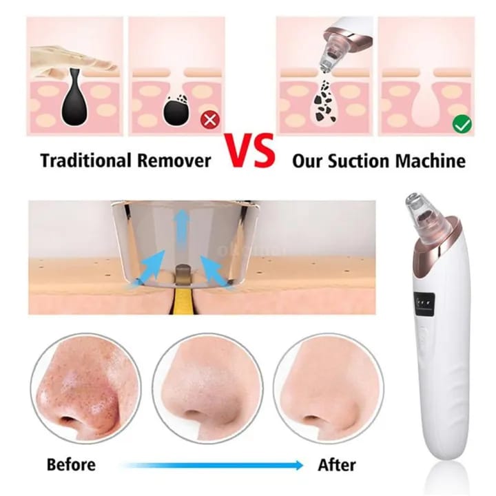 Face Vacuum Suction Blackhead Remover Pore Cleaner | Electric Deep Cleansing Tool for Nose & Face